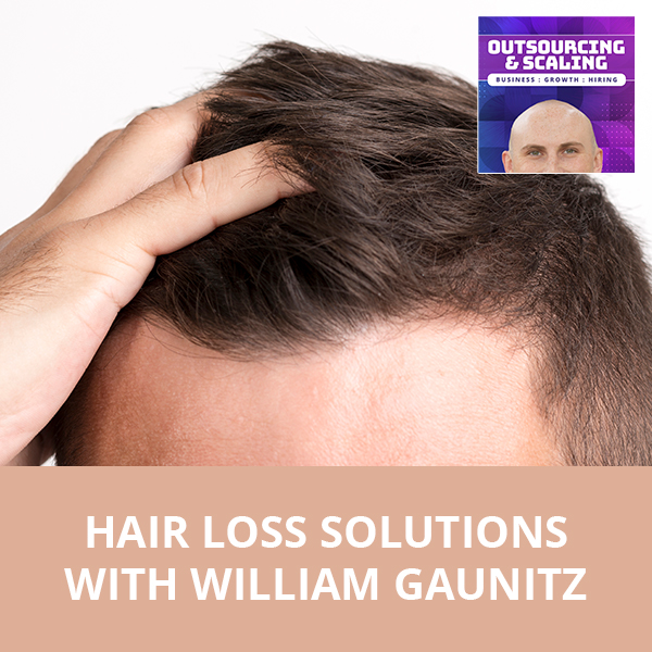 OAS William | Hair Loss Solutions